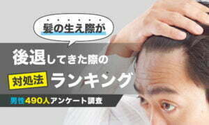 【髪の生え際が後退してきた際の対処法ランキング】男性490人アンケート調査